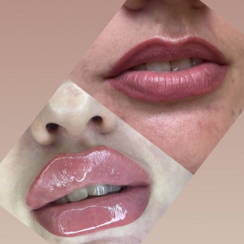 Вікторія Кравченко, Миргород Фото - 9