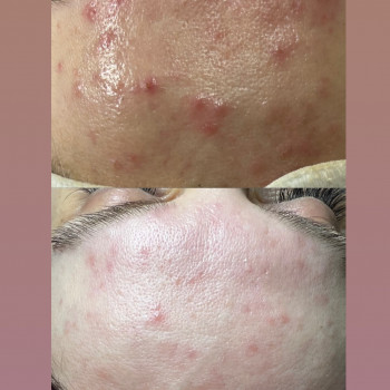 Вікторія Ковальова, Львов Фото - 5