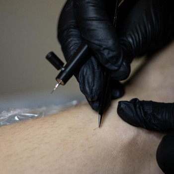 Електроепіляція
                    Косметологічний центр Laser Impulse Тернопіль