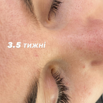 Инна Неділько, Вишневе Фото - 9