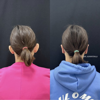 Абдель Эрритали, Київ Фото - 7