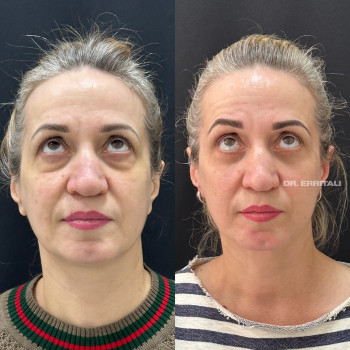 Абдель Эрритали, Київ Фото - 8