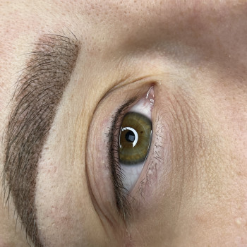 Ніжна міжвійка