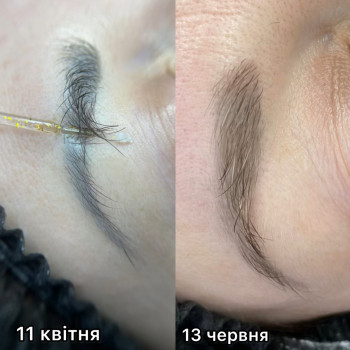 Результат 1 сеансу видалення ремувером