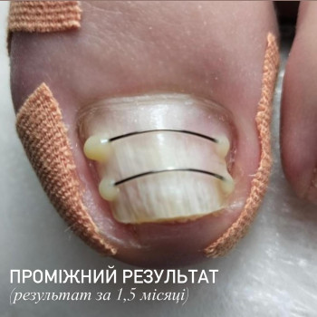 Центр подології Дарії Кузьменко, Київ Фото - 5