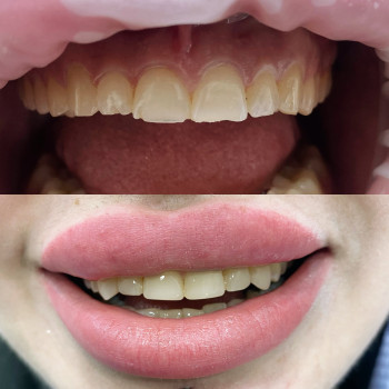 Сеймур Теймуров, Харьков Фото - 5