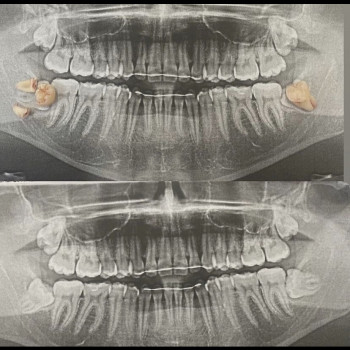 Сеймур Теймуров, Харьков Фото - 6