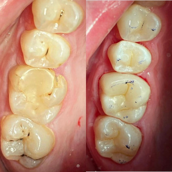 Сеймур Теймуров, Харьков Фото - 7