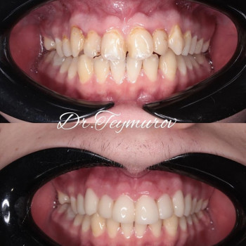 Сеймур Теймуров, Харьков Фото - 10