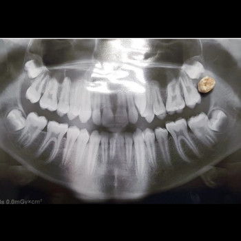Сеймур Теймуров, Харьков Фото - 11