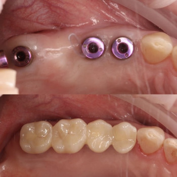 Сеймур Теймуров, Харьков Фото - 14