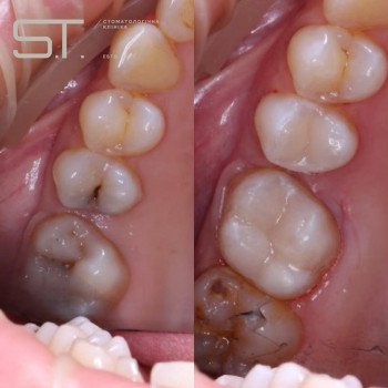 Сеймур Теймуров, Харьков Фото - 15