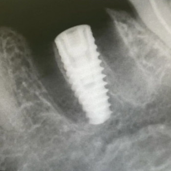 Сеймур Теймуров, Харьков Фото - 16