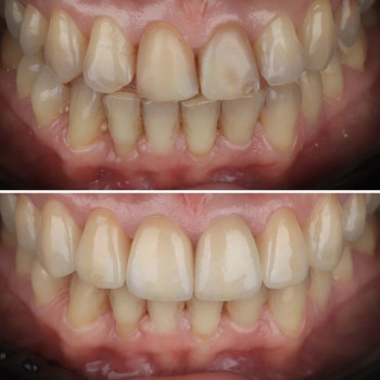 Сеймур Теймуров, Харьков Фото - 19