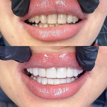 Сеймур Теймуров, Харьков Фото - 20