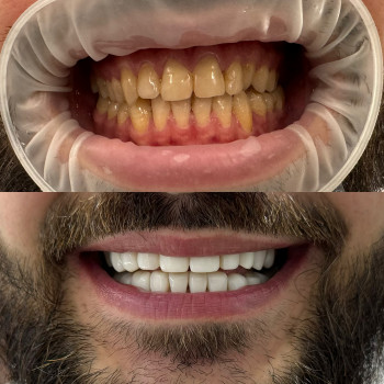 Сеймур Теймуров, Харьков Фото - 21