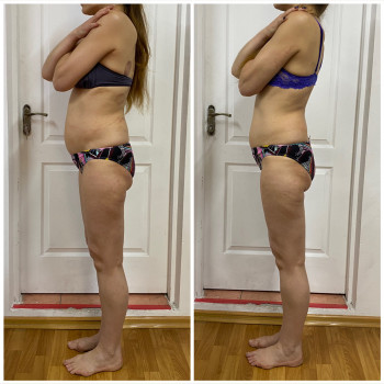 Виталий Иванов, Черноморск Фото - 20