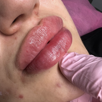 Виталий Иванов, Черноморск Фото - 21