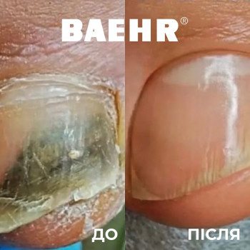 Baehr, Київ Фото - 5