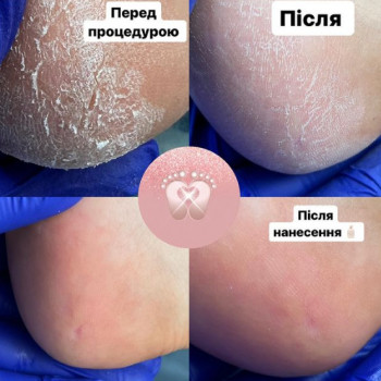 Ольга Харченко, Киев Фото - 5