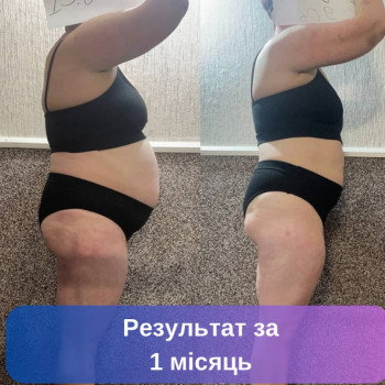 Світлана Фус, Київ Фото - 5