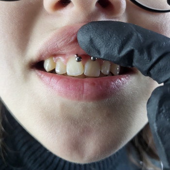 Нік Пірсинг, Белая Церковь Фото - 13