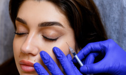 Ін'єкції Полінуклеотидів Косметологічний центр Клініка естетичної медицини Мирослави Новосільської Ужгород