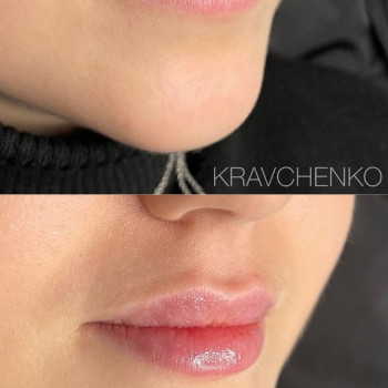 Филипп Кравченко, Киев Фото - 15