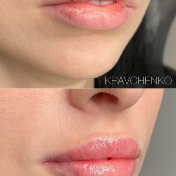 Филипп Кравченко, Киев Фото - 62