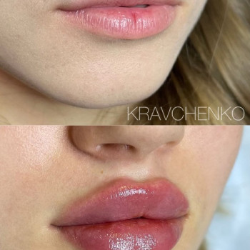 Филипп Кравченко, Киев Фото - 18