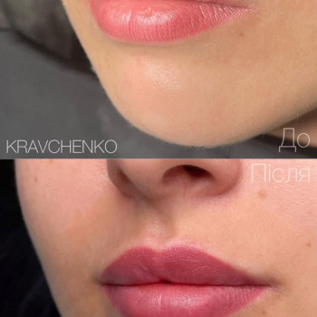 Филипп Кравченко, Киев Фото - 63