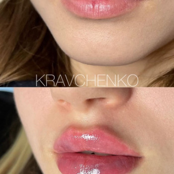 Филипп Кравченко, Киев Фото - 61