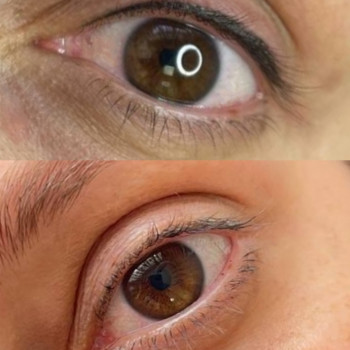 Оксана Коренецька, Кропивницький Фото - 6