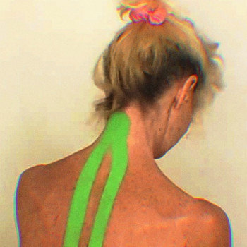 Ремінній м'яз голови