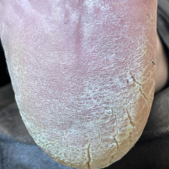 Юлия Волошко, Днепр Фото - 5