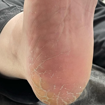 Юлия Волошко, Днепр Фото - 6