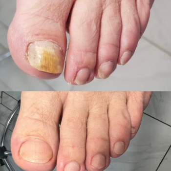 Екатерина Прокопенко, Днепр Фото - 5