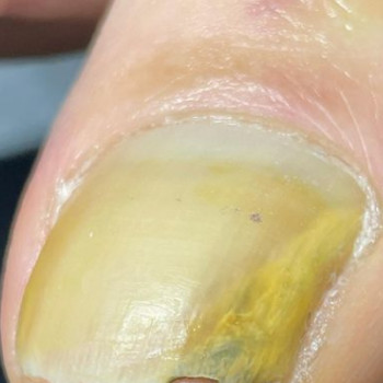 Татьяна Литвинова, Днепр Фото - 7