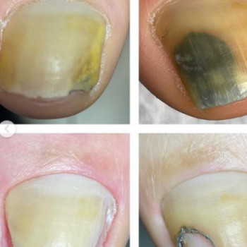 Татьяна Литвинова, Днепр Фото - 8