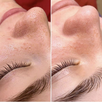 Анастасія Руденок, Чернігів Фото - 10