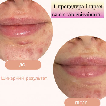 Анастасія Руденок, Чернігів Фото - 9