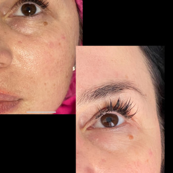 Анастасія Руденок, Чернігів Фото - 8