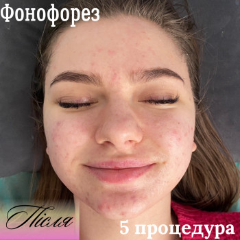 Анастасія Руденок, Чернігів Фото - 6