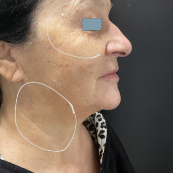 Анастасія Руденок, Чернігів Фото - 3