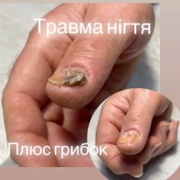 Тетяна Ткаченко, Харків Фото - 5