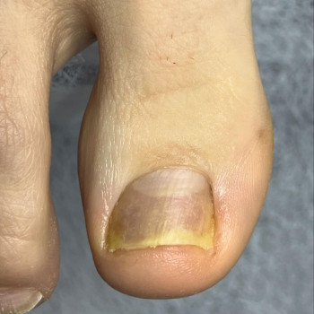 Виктория Зиновьева, Харьков Фото - 5