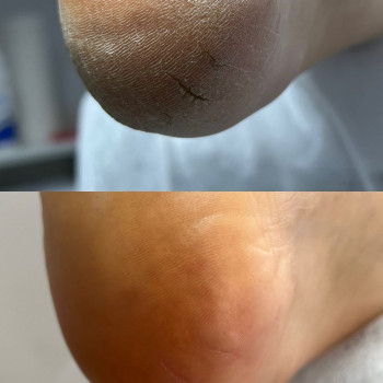 Виктория Зиновьева, Харьков Фото - 6