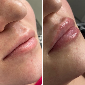 Вера Прудская, Бровары Фото - 5