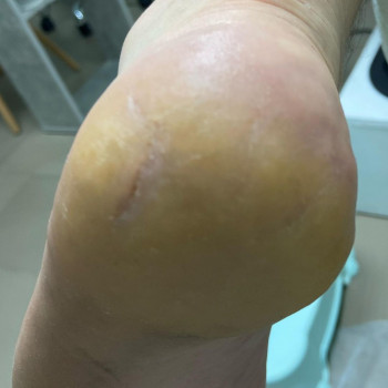 Анна Тімченко, Харків Фото - 5