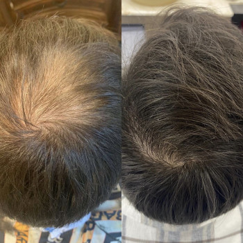 Підібрали домашній догляд, лікувальну сироватку та бади.